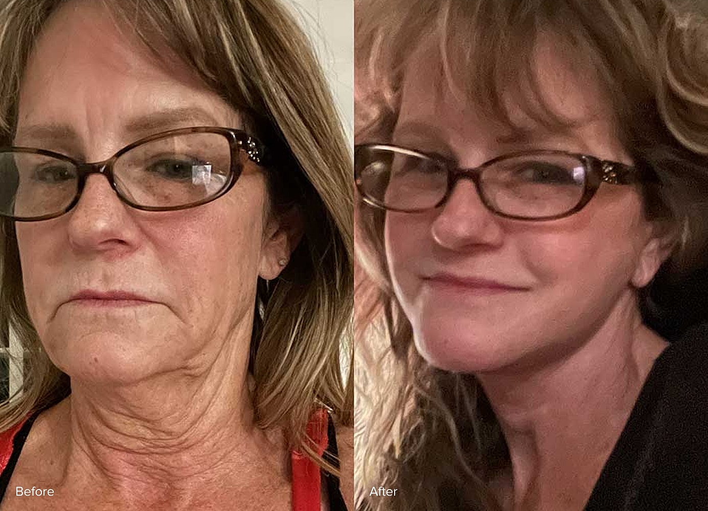 Before and after aging appearance comparison.