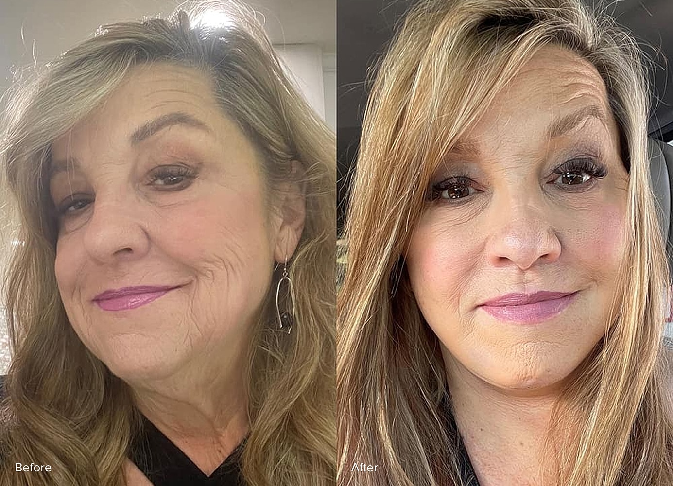 Before and after facial makeover comparison.
