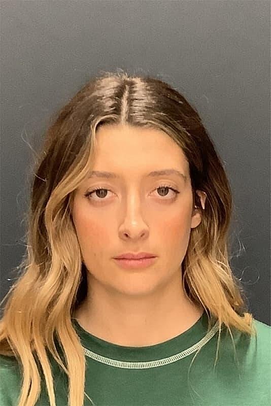 Rhinoplasty Before & After