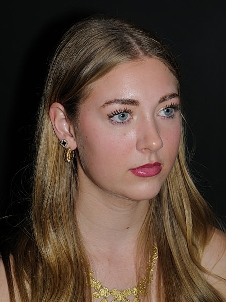 Rhinoplasty Before & After