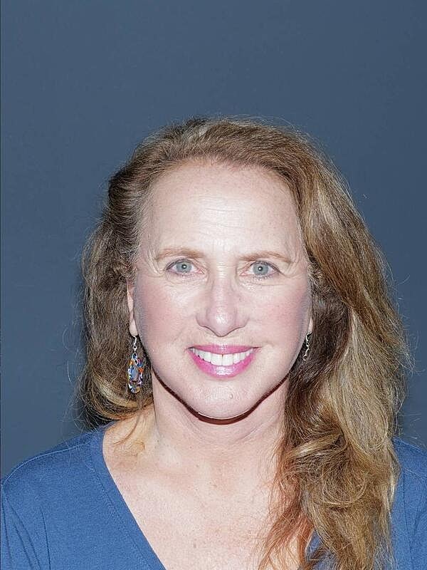 Facelift Neck Lift Before & After