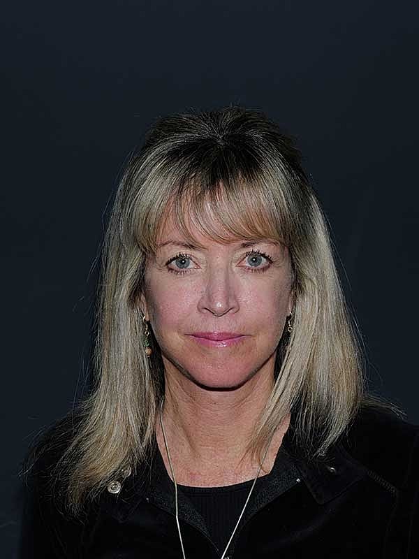 Facelift Neck Lift Before & After